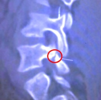 LA FOTO DELLA RADIOGRAFIA LA FOTO DELLA RADIOGRAFIA
