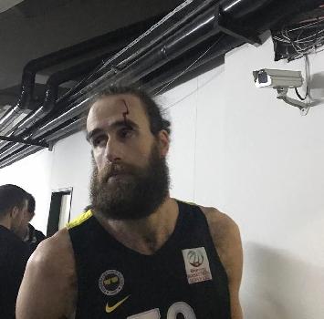Basket: Datome colpito da un oggetto in testa