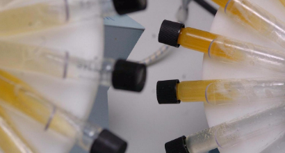Doping, Foto LaPresse