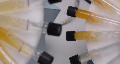 Doping, Foto LaPresse