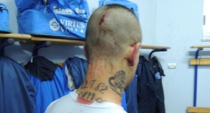Violenze Giugliano-Volla, foto tratta da ilmattino.it Violenze Giugliano-Volla, foto tratta da ilmattino.it