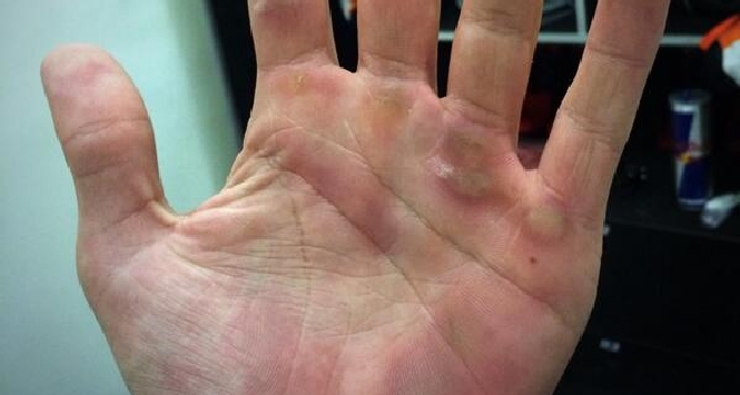 La Mano di Marquez, Foto da Twitter La Mano di Marquez, Foto da Twitter