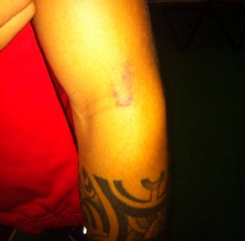 Comi come Suarez: morso a De Luca 34 C 29 articolo 1044991 upiImgPrincipaleVert